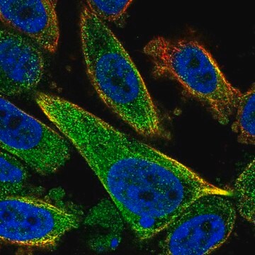 Anti-TCTEX1D2 antibody produced in rabbit Prestige Antibodies&#174; Powered by Atlas Antibodies, affinity isolated antibody, buffered aqueous glycerol solution