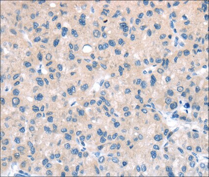 Anti-TTI1 affinity isolated antibody