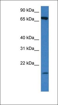 Anti-SLC5A2 antibody produced in rabbit affinity isolated antibody