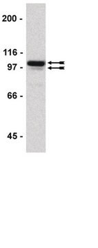 ChIPAb+ Sp1 - ChIP Validated Antibody and Primer Set from rabbit