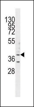 ANTI-B3GALT5 (N-TERM) antibody produced in rabbit IgG fraction of antiserum, buffered aqueous solution