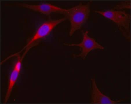 Anti-IDH1 antibody produced in rabbit ~1.0&#160;mg/mL, affinity isolated antibody