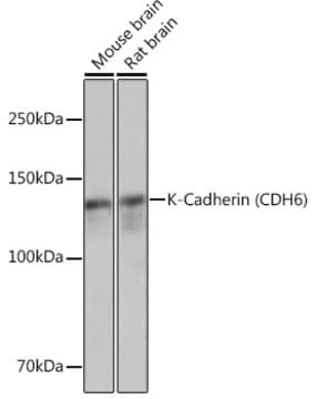 Anti-K-Cadherin (CDH6) Antibody, clone 5N2K3, Rabbit Monoclonal