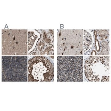 Anti-SERTAD2 antibody produced in rabbit Prestige Antibodies&#174; Powered by Atlas Antibodies, affinity isolated antibody, buffered aqueous glycerol solution, Ab1