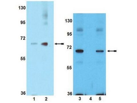 Anticuerpo anti-fosfo-PAK1 (Ser199 / Ser204) Upstate&#174;, from rabbit