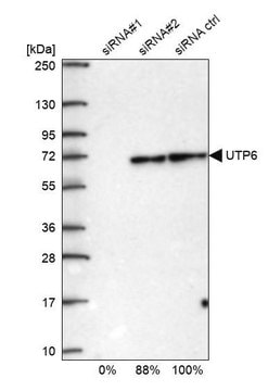 Anti-UTP6 antibody produced in rabbit Prestige Antibodies&#174; Powered by Atlas Antibodies, affinity isolated antibody, buffered aqueous glycerol solution