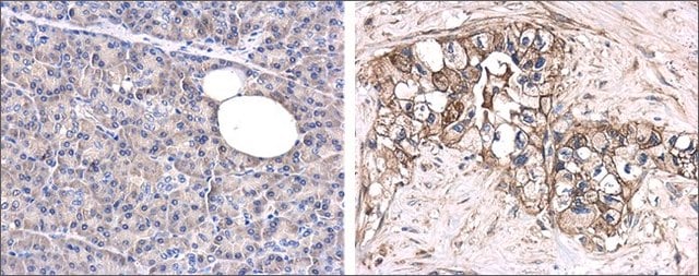 Anti-GPC1 antibody produced in rabbit affinity isolated antibody, buffered aqueous solution