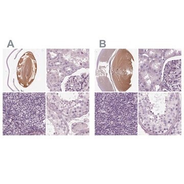 Anti-BFSP1 antibody produced in rabbit Prestige Antibodies&#174; Powered by Atlas Antibodies, affinity isolated antibody, buffered aqueous glycerol solution