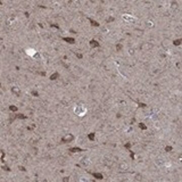 Anti-NCEH1 antibody produced in rabbit Prestige Antibodies&#174; Powered by Atlas Antibodies, affinity isolated antibody, buffered aqueous glycerol solution