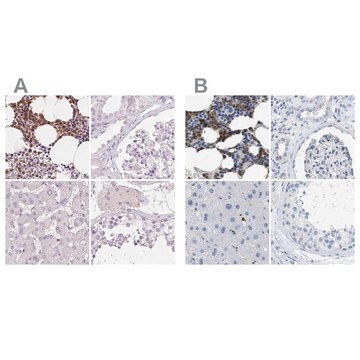 Anti-SERPINB1 antibody produced in rabbit Prestige Antibodies&#174; Powered by Atlas Antibodies, affinity isolated antibody, buffered aqueous glycerol solution