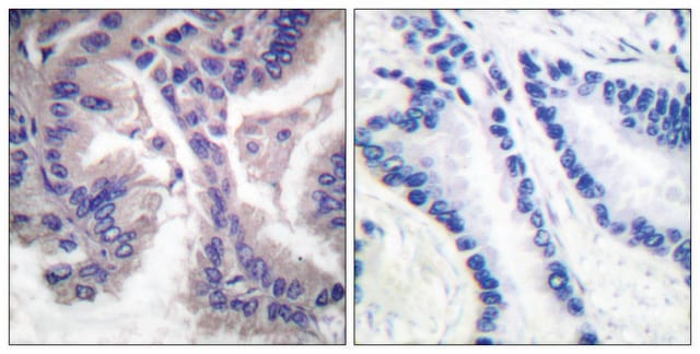 Anti-CASP6 (Cleaved-Asp162) antibody produced in rabbit affinity isolated antibody