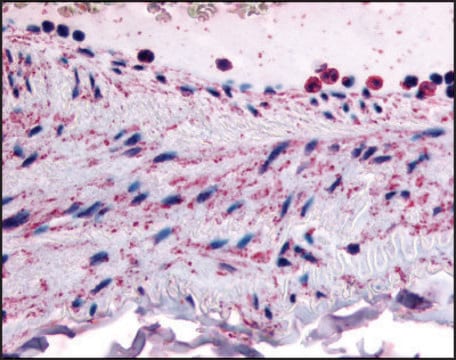 Anti-PTPMT1 (AB1) antibody produced in rabbit affinity isolated antibody, buffered aqueous solution