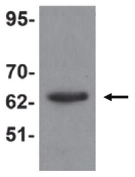 Anti-KPNA6 Antibody from rabbit, purified by affinity chromatography