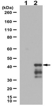 Anti-phospho-Neuroligin-1/NL-1 (Thr739) from rabbit, purified by affinity chromatography