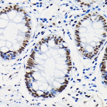 Anti-Phospho-RB(pSer780) Antibody, clone 8R5F5, Rabbit Monoclonal