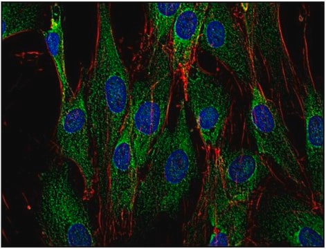 Monoclonal Anti-SOS antibody produced in mouse clone SOS-01