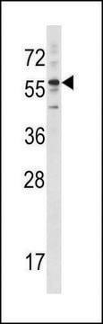 ANTI-KRT3 (CENTER) antibody produced in rabbit IgG fraction of antiserum, buffered aqueous solution