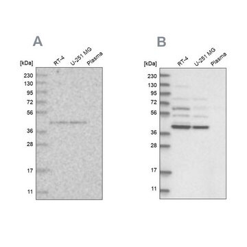 Anti-GPN1 antibody produced in rabbit Prestige Antibodies&#174; Powered by Atlas Antibodies, affinity isolated antibody, buffered aqueous glycerol solution