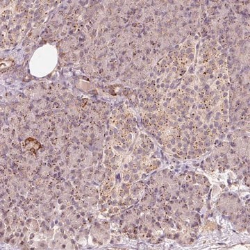 Anti-ZNF460 antibody produced in rabbit Prestige Antibodies&#174; Powered by Atlas Antibodies, affinity isolated antibody, buffered aqueous glycerol solution