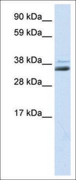 Anti-SFRP1 antibody produced in rabbit IgG fraction of antiserum