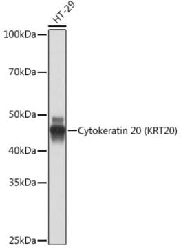 Anti-Cytokeratin 20 (KRT20) Antibody, clone 8C6A3, Rabbit Monoclonal