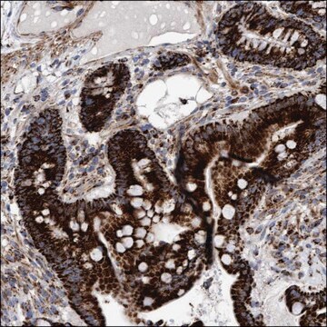 Anti-TET1 antibody produced in rabbit Prestige Antibodies&#174; Powered by Atlas Antibodies, affinity isolated antibody, buffered aqueous glycerol solution