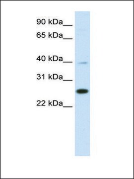 Anti-YAF2 antibody produced in rabbit affinity isolated antibody