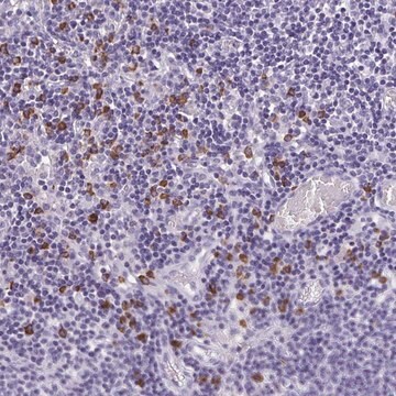 Anti-PSD antibody produced in rabbit Prestige Antibodies&#174; Powered by Atlas Antibodies, affinity isolated antibody, buffered aqueous glycerol solution