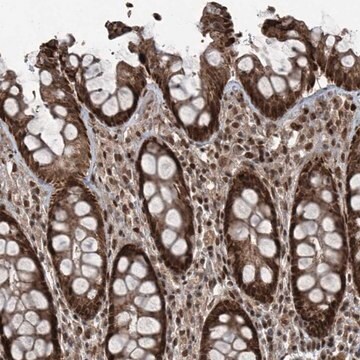 Anti-ZNF570 antibody produced in rabbit Prestige Antibodies&#174; Powered by Atlas Antibodies, affinity isolated antibody, buffered aqueous glycerol solution