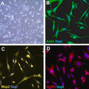 GN11 Mouse GnRH Neuronal Cell Line The GN11 mouse neuronal cell line is an immortalized cell line established as a model of GnRH-secreting neurons.