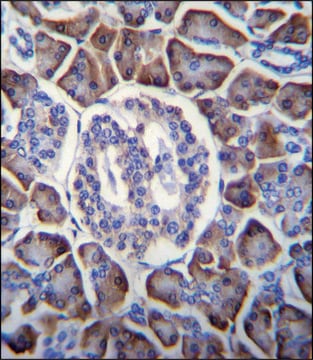 ANTI-GDPD1 (N-TERM) antibody produced in rabbit IgG fraction of antiserum, buffered aqueous solution