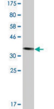 Monoclonal Anti-TTF2 antibody produced in mouse clone 1E4, ascites fluid, solution