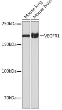 Anti-VEGFR1 Antibody, clone 7F1A3, Rabbit Monoclonal