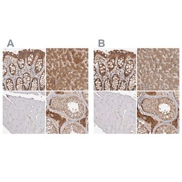 Anti-ACAT2 antibody produced in rabbit Prestige Antibodies&#174; Powered by Atlas Antibodies, affinity isolated antibody, buffered aqueous glycerol solution, Ab3