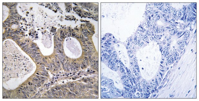 Anti-STEA2 antibody produced in rabbit affinity isolated antibody