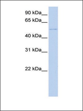 Anti-DCX (AB2) antibody produced in rabbit affinity isolated antibody