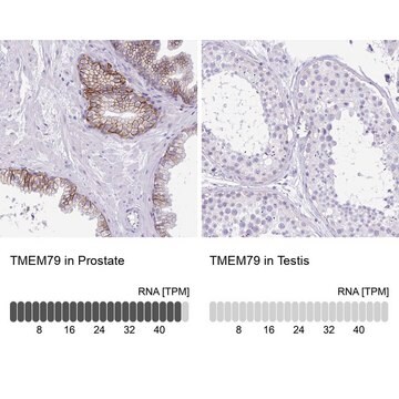 Anti-TMEM79 antibody produced in rabbit Prestige Antibodies&#174; Powered by Atlas Antibodies, affinity isolated antibody, buffered aqueous glycerol solution