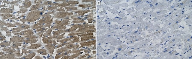 Anti-&#946;2-Adrenergic Receptor Antibody, clone 2B23 ZooMAb&#174; Rabbit Monoclonal recombinant, expressed in HEK 293 cells