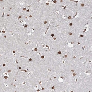 Anti-ATP11B antibody produced in rabbit Prestige Antibodies&#174; Powered by Atlas Antibodies, affinity isolated antibody, buffered aqueous glycerol solution