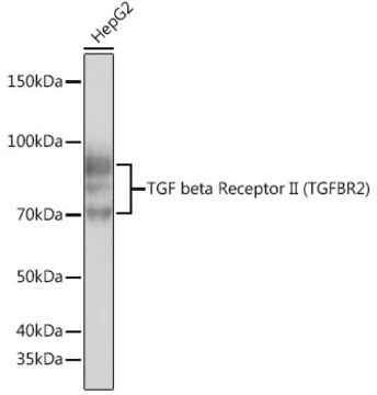 Anti-TGF beta Receptor II (TGFBR2) Antibody, clone 2M8Y2, Rabbit Monoclonal