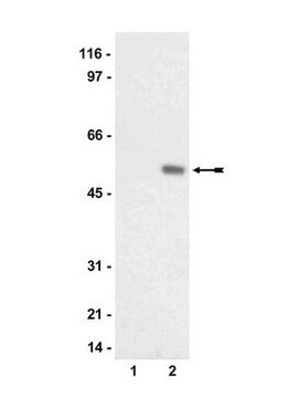 Anti-phospho-SGK Antibody serum, Upstate&#174;