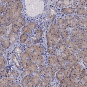 Anti-CEP128 antibody produced in rabbit Ab1, Prestige Antibodies&#174; Powered by Atlas Antibodies, affinity isolated antibody, buffered aqueous glycerol solution