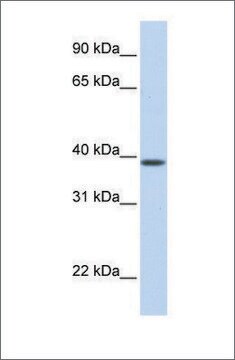 Anti-SLC25A42 antibody produced in rabbit affinity isolated antibody