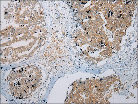 Anti-ZNF621 affinity isolated antibody