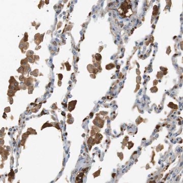 Anti-ADCY10 antibody produced in rabbit Prestige Antibodies&#174; Powered by Atlas Antibodies, affinity isolated antibody, buffered aqueous glycerol solution