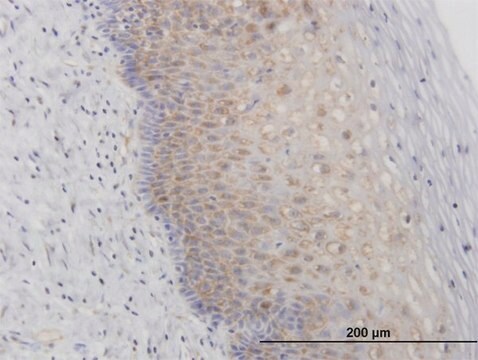 Anti-RPL29 antibody produced in mouse IgG fraction of antiserum, buffered aqueous solution