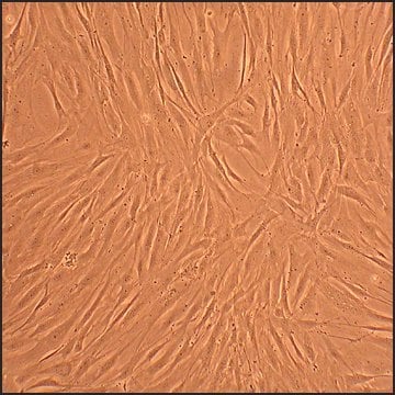 Human Osteoblasts-Rheumatoid Arthritis: HOb-RA, adult