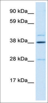 Anti-LASS3 antibody produced in rabbit affinity isolated antibody