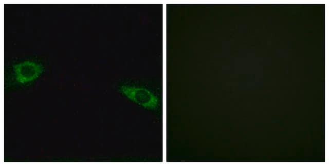 Anti-RPS4Y1 antibody produced in rabbit affinity isolated antibody