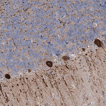 Anti-CMBL antibody produced in rabbit Prestige Antibodies&#174; Powered by Atlas Antibodies, affinity isolated antibody, buffered aqueous glycerol solution